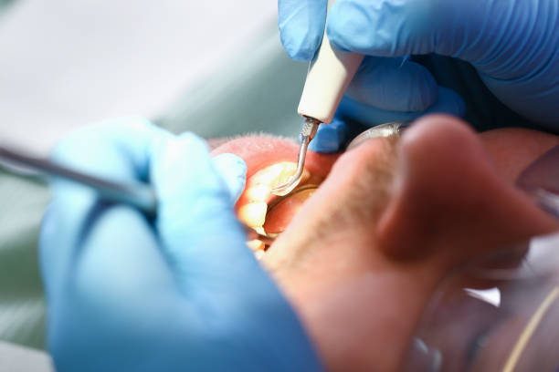 Best Emergency Denture Repair in Paulding, OH