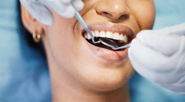 Best Lost Filling or Crown Replacement in Paulding, OH