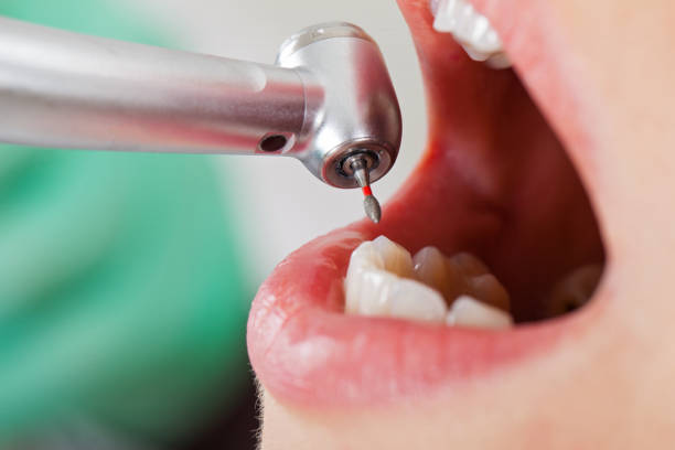 Best Emergency Cosmetic Dentistry (e.g., broken veneers) in Paulding, OH